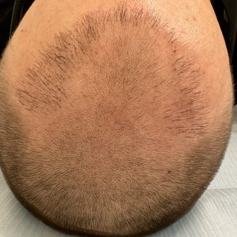 Before image