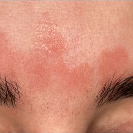 Before image