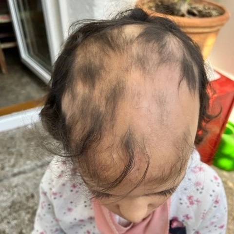 Before image