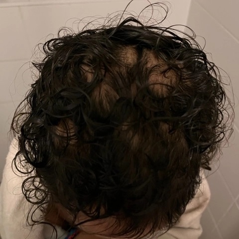 After image